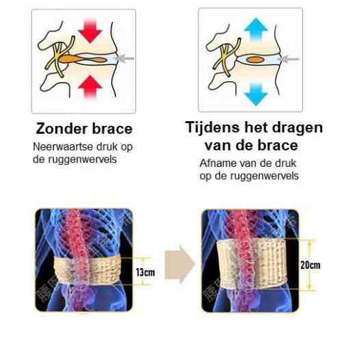 Decompressiebrace - Trek je Rug, Verlicht je Dag