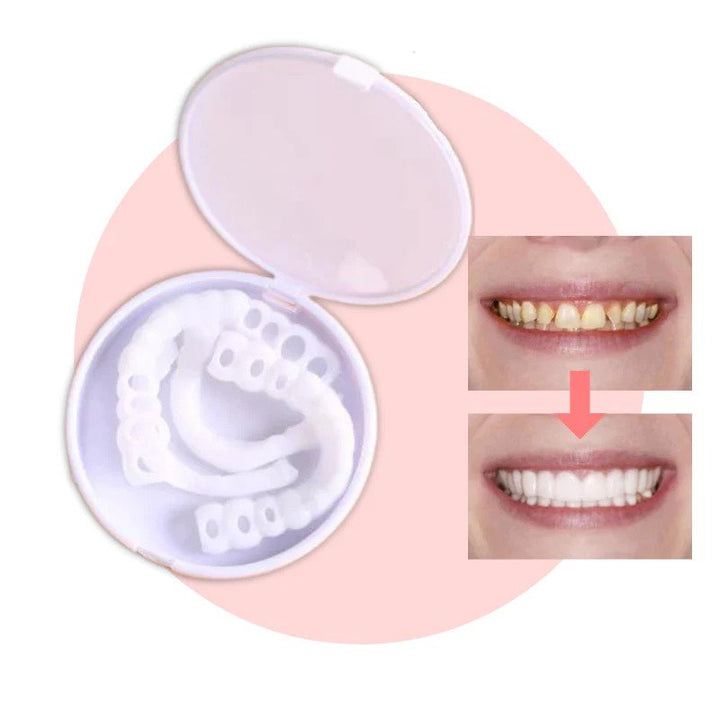 Klik-veneers | Flexibele pasvorm zonder lijm voor maaltijden en dagelijks gebruik