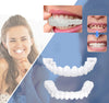 Snap-On Veneers | Flexibele, lijmloze pasvorm voor maaltijden en dagelijks gebruik