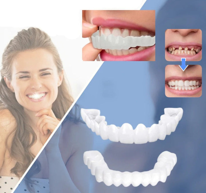 Klik-veneers | Flexibele pasvorm zonder lijm voor maaltijden en dagelijks gebruik