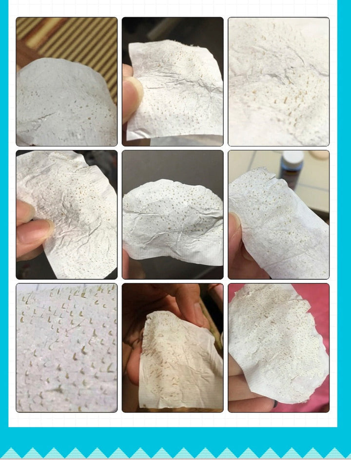 Face Formula - Mee-eter verwijderende neusstrips