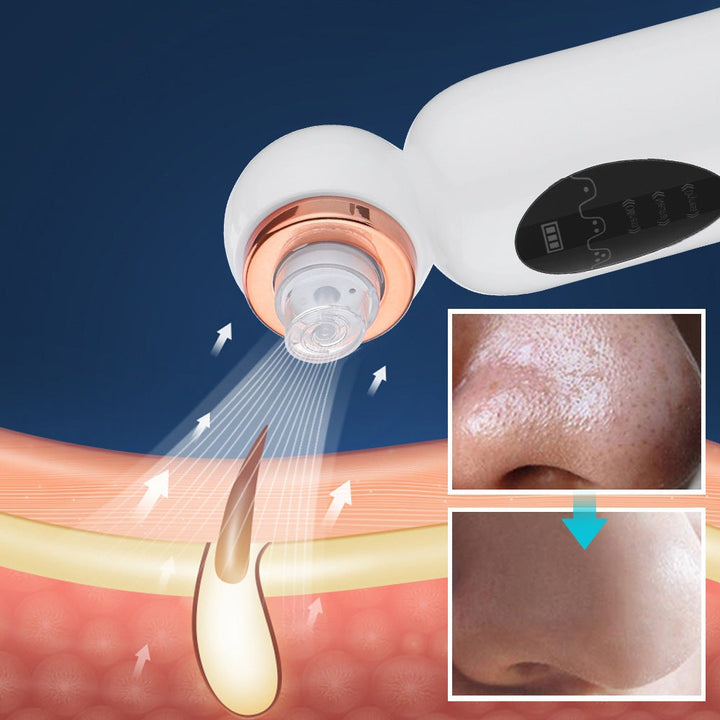Mee-eter Verwijderaar en Hydrodermabrasie - HydraGlow - SkinzLine