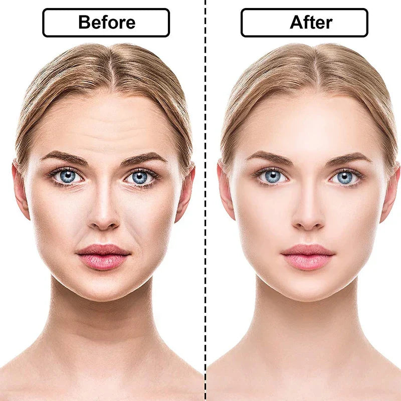 DermaSilva – Siliconen Anti-Rimpel Pad Set voor Gezicht, Hals &amp; Decolleté - SkinzLine