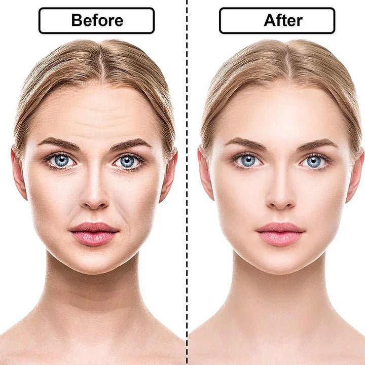 DermaSilva – Siliconen Anti-Rimpel Pad Set voor Gezicht, Hals &amp; Decolleté - SkinzLine