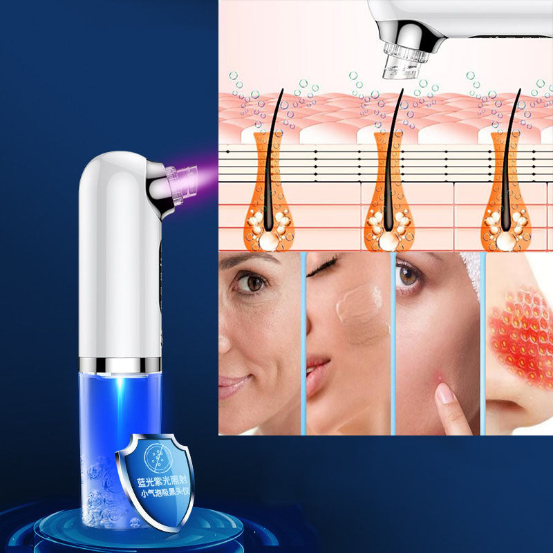 
                  
                    Gaina – Professioneel Diepreinigend Microdermabrasieapparaat met Waterzuiging - SkinzLine
                  
                